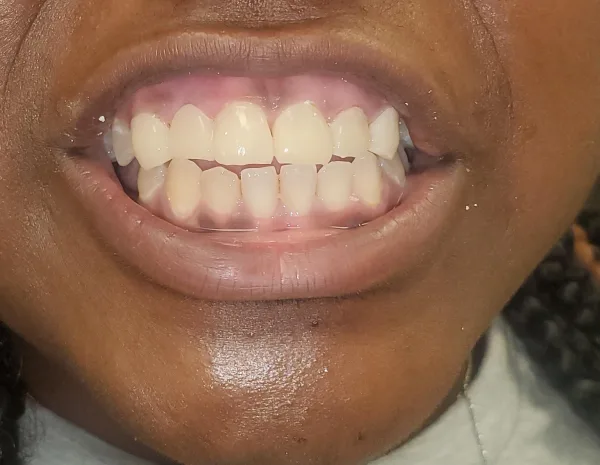 Rodin® Sculpture - Image 2